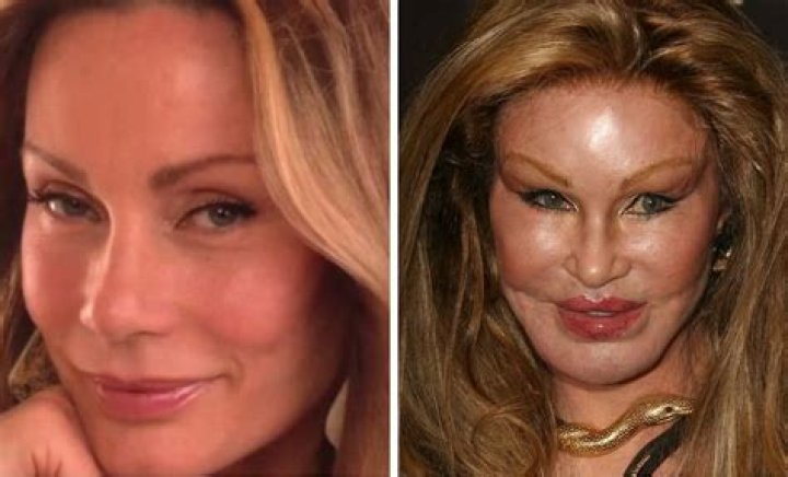 10 Extreme Cases of Celebrity Wannabe Plastic Surgery