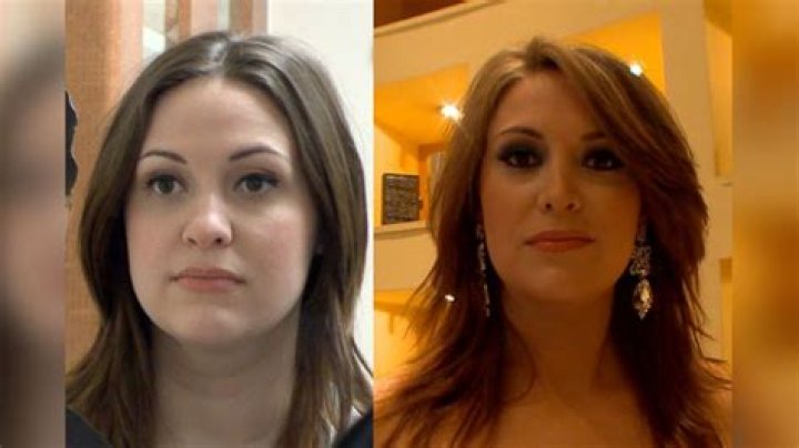 Kitty Jay's $25K Plastic Surgery to Resemble Jennifer Lawrence