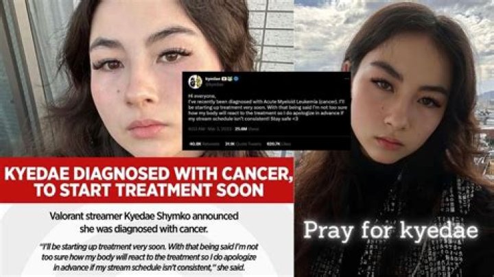 Kyedae Leukaemia Treatment And Cancer Update – Health Age And Wikipedia Bio