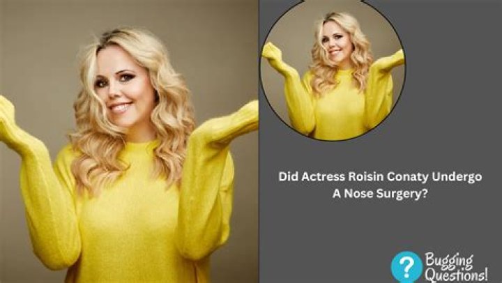 Roisin Conaty Nose Job – Did She Get Surgery? Health Update And Weight Loss